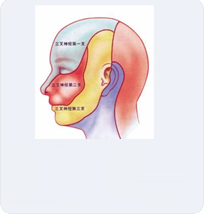 三叉神經(jīng)痛與普通頭疼